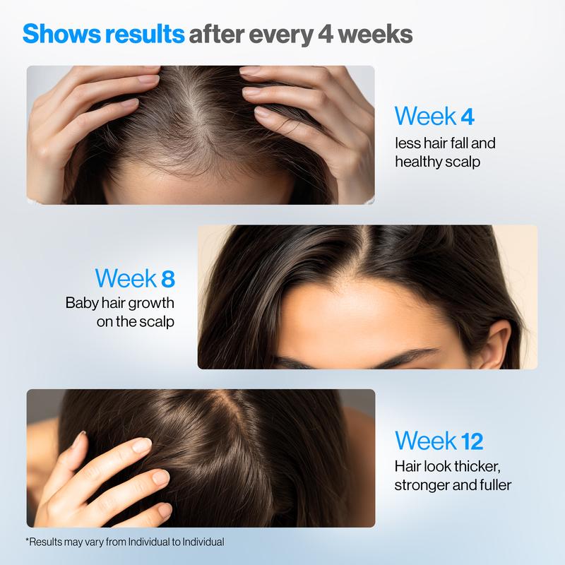 ✨ Bodywise Hair Growth Serum Roll-On – Boosts Roots, Revives Thinning Hair Naturally