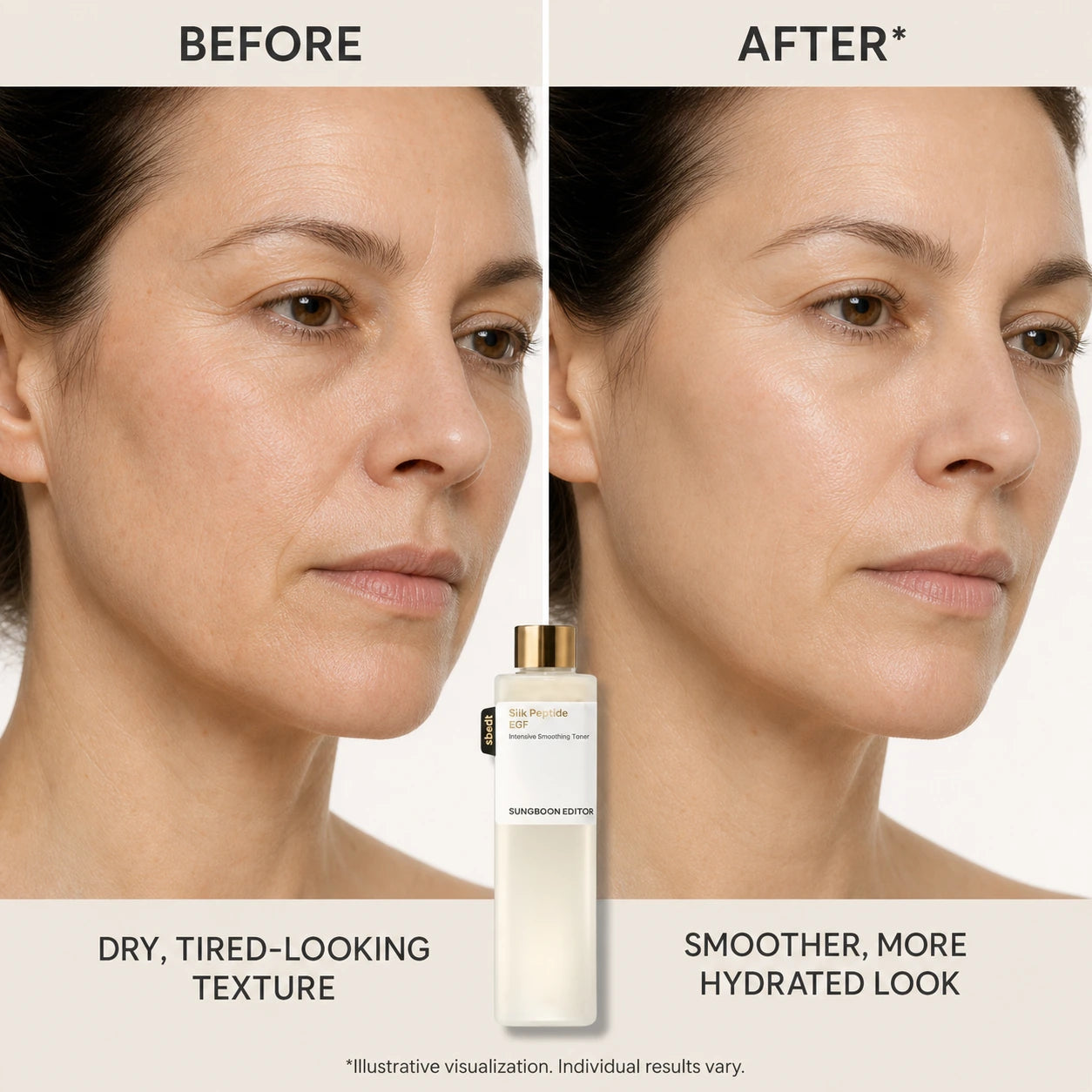 [Sungboon] EGF Toner | Forehead Firming & Wrinkle Care, Iron Out Fine Lines | PDRN & Volufiline & Collagen & NAD+ EGF Complex | EGF Plumping for Forehead, Longevity Anti-Aging Routine | Korean Skincare, K-Beauty