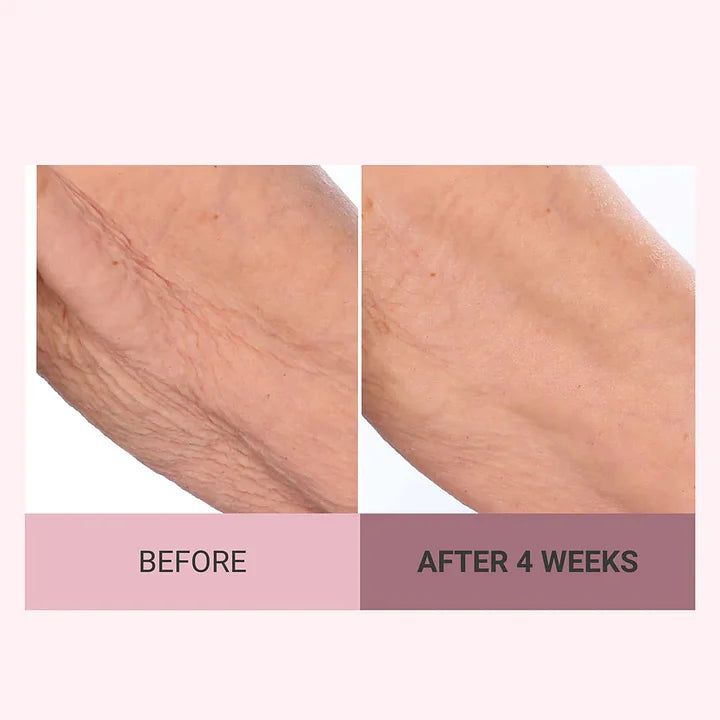 💆‍♀️ Experience Ultimate Luxury - 50% OFF - ✨ Champagne Beaute Lift Firming Body Crème - For Firmer, Smoother, Radiant Skin! 🌟