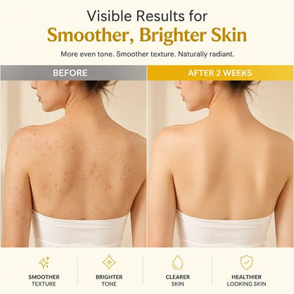 [medicube] Smooth & Clear Body Care Set | Hypochlorous Acid Body Peel Shot, Kojic Acid Turmeric Body Wash, Toner Pad, Toner, Mist | Exfoliating for Dead Skin Cells & Excess Sebum & Clearing for After Spots, Texture & Uneven Skin Tone | K-Beauty
