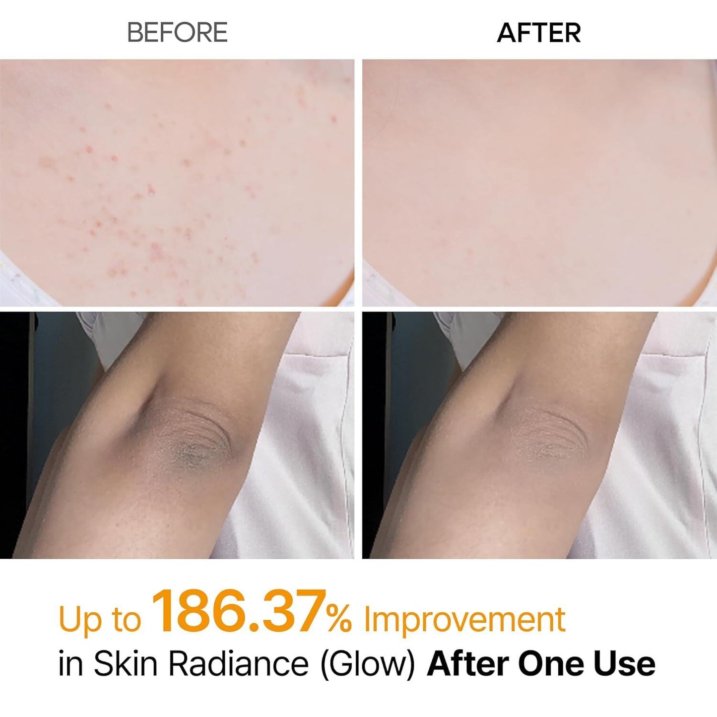 🔥[5𝟎% 𝐎𝐅𝐅 𝐋𝐀𝐒𝐓 𝐓𝐇𝐑𝐄𝐄 𝐃𝐀𝐘𝐒]Dr.melaxin Peel Shot Keratin Care Kojic Acid Turmeric Spray 200ml Pore Clearing Exfoliating Formula Skin Repair Scrub