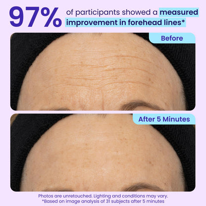 NEW Instant Lift Eye Gel - For the look of Puffiness & Bags, Wrinkles, Fine Lines and Dark Circles, Anti Aging Skin Care for Men & Women with MaxLift3 Biotech Under Eye Brightener