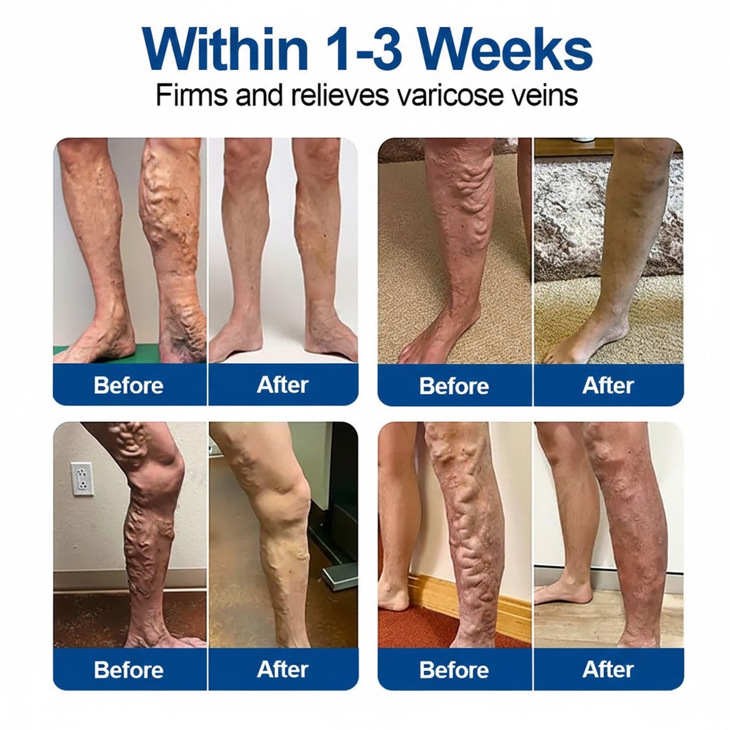 🇺🇸 🥰GFOUK® VeinEase Microneedle Care Patch⚡Instant Relief, Long-Term Results