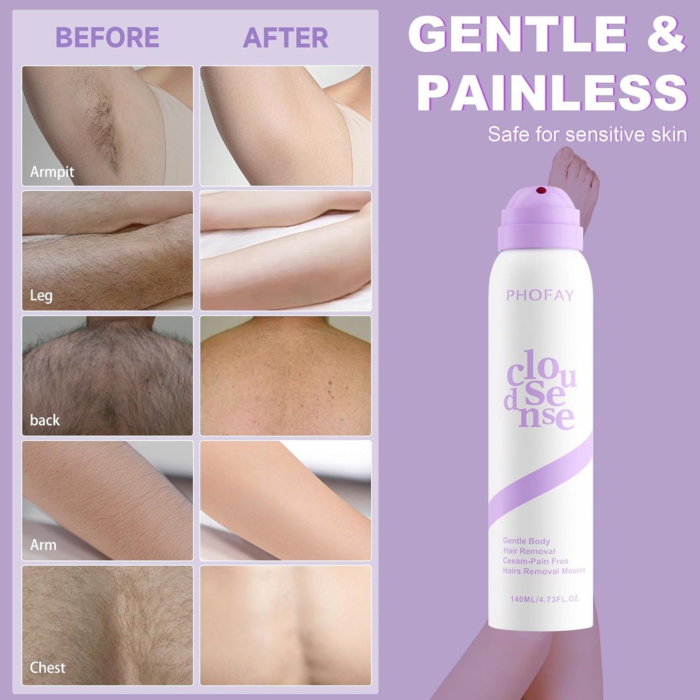 PHOFAY Hair Removal Cream for Sensitive Skin – Fast-Acting, with Aloe & Hyaluronic Acid Spray Depilatory Dermatologist-Recommended