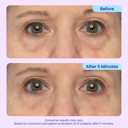NEW Instant Lift Eye Gel - For the look of Puffiness & Bags, Wrinkles, Fine Lines and Dark Circles, Anti Aging Skin Care for Men & Women with MaxLift3 Biotech Under Eye Brightener