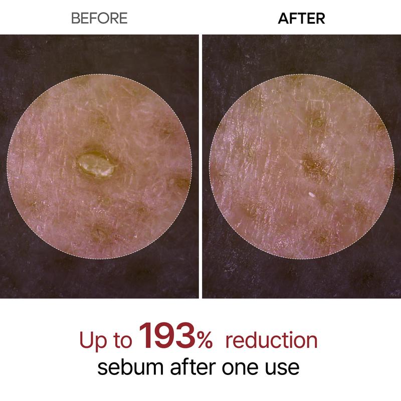 Dr.Melaxin Peel Shot Glow White and Black Rice Ampoule Duo, Soft Exfoliating Face and Body Scrub Dead Skin Cells, Blackheads Remover for All Skin Types