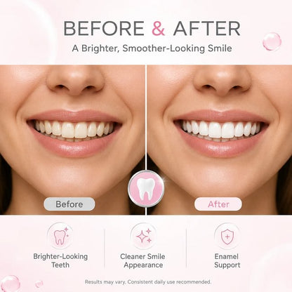 Hismile Tooth Armour Fluoride Free Toothpaste Serum, Nano Hydroxyapatite Toothpaste, Appropriate for Sensitive Teeth, Supports Tooth Enamel, Niacinamide Toothpaste, Advanced Enamel Support | 20 ml