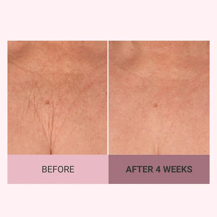 💆‍♀️ Experience Ultimate Luxury - 50% OFF - ✨ Champagne Beaute Lift Firming Body Crème - For Firmer, Smoother, Radiant Skin! 🌟