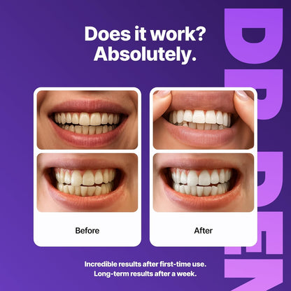 🦷DRDENT Purple Teeth Whitening Strips - 7/21 Whitening Sessions - Non Sensitive Teeth Whitening - Peroxide-Free🦷