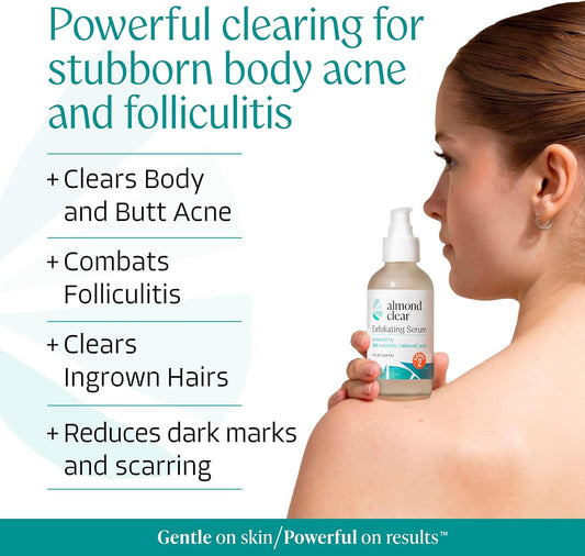 Body Clearing Serum [1 Fl Oz] Level 2 Acne Serum - Advanced Formula for Body Acne, Folliculitis, Back, Butt, Chest, Thighs, Shoulders - Mandelic Acid