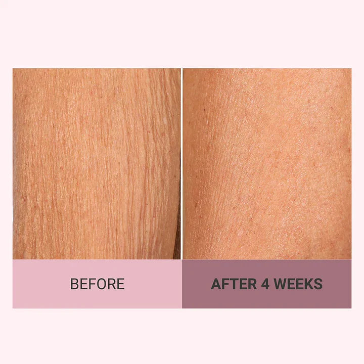 💆‍♀️ Experience Ultimate Luxury - 50% OFF - ✨ Champagne Beaute Lift Firming Body Crème - For Firmer, Smoother, Radiant Skin! 🌟