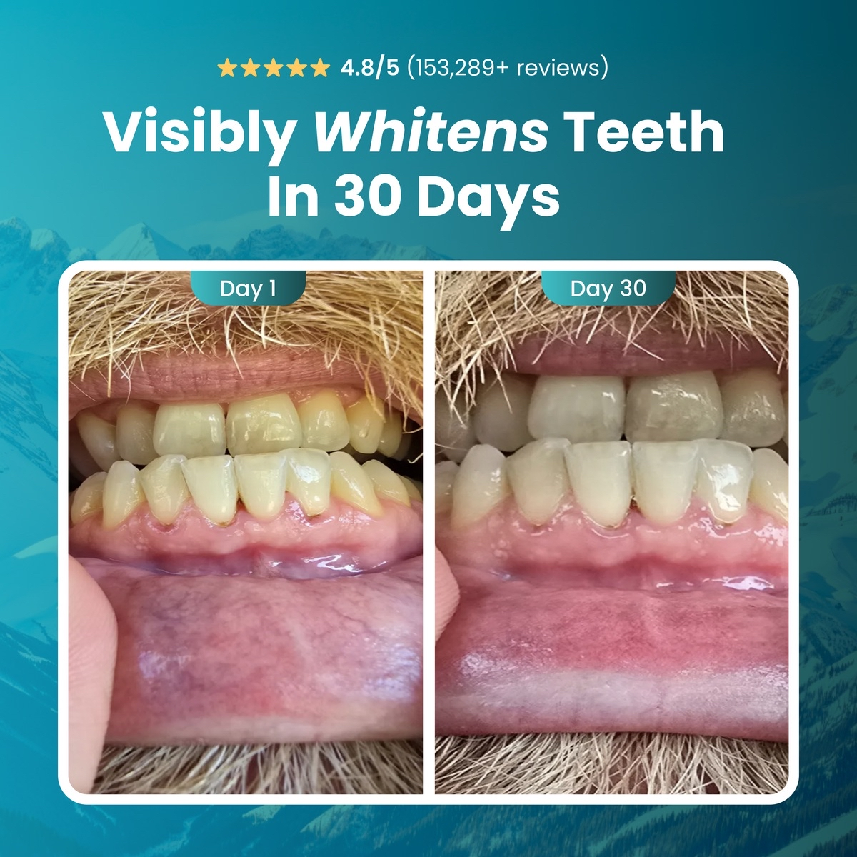 Remineralizing Gum, Underbrush Remineralizing Chewing Gum, Organic Mastic Mint Sugar-Sugar-Free for Whiten Teeth Health Chewing Gum to Keeps Your Mouth Fresh