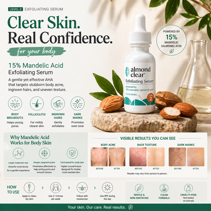Body Clearing Serum [1 Fl Oz] Level 2 Acne Serum - Advanced Formula for Body Acne, Folliculitis, Back, Butt, Chest, Thighs, Shoulders - Mandelic Acid-L
