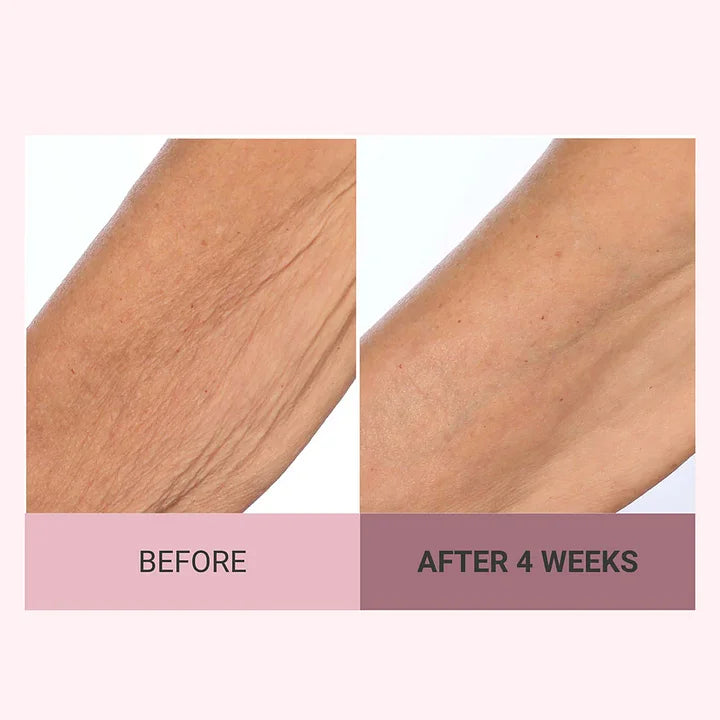 💆‍♀️ Experience Ultimate Luxury - 50% OFF - ✨ Champagne Beaute Lift Firming Body Crème - For Firmer, Smoother, Radiant Skin! 🌟