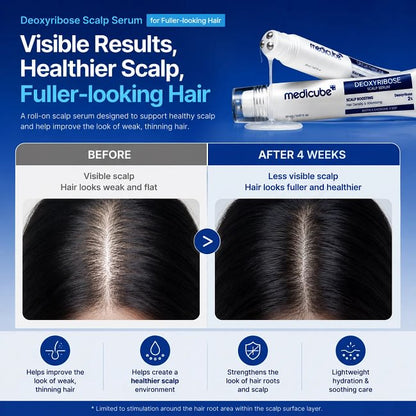 [NEW] [medicube] Deoxyribose Scalp Serum | For Fuller-Looking Hair & Scalp Strengthening Roll-On Serum | Deoxyribose, Rosemary, EGF, Caffeine for Fine, Thin Hair | Korean Hair Care, K-Beauty